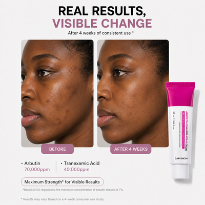 Arbutin 7% + Tranexamic Acid 4% Cream