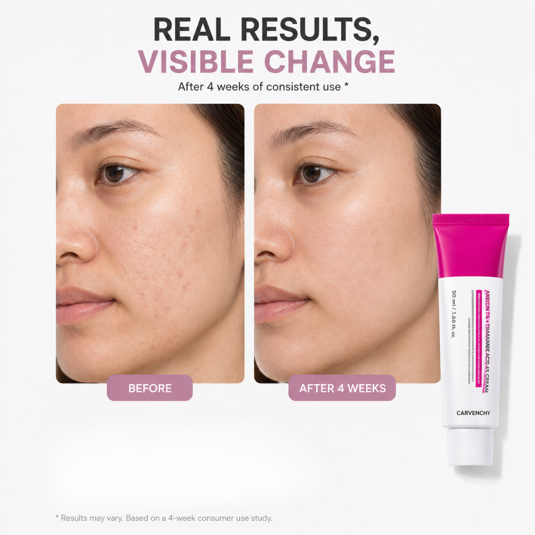 Arbutin 7% + Tranexamic Acid 4% Cream